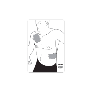 Adult Pad Placement Guide 4 OH_PNG-MEDICAL (FINAL) - 3-12